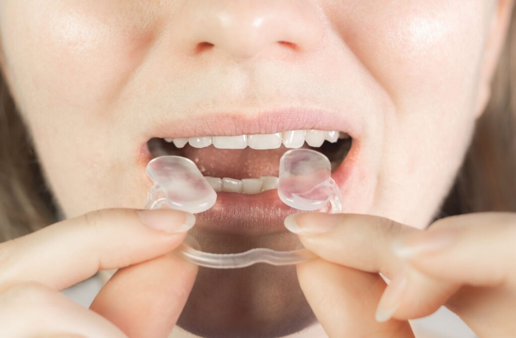 A close-up image of someone putting their mouth guard in for the evening to prevent clenching and tooth grinding while they sleep.
